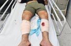 عامل حمله به بانوان با شلیک پلیس زمینگیر شد عامل حمله به بانوان با شلیک پلیس زمینگیر شد