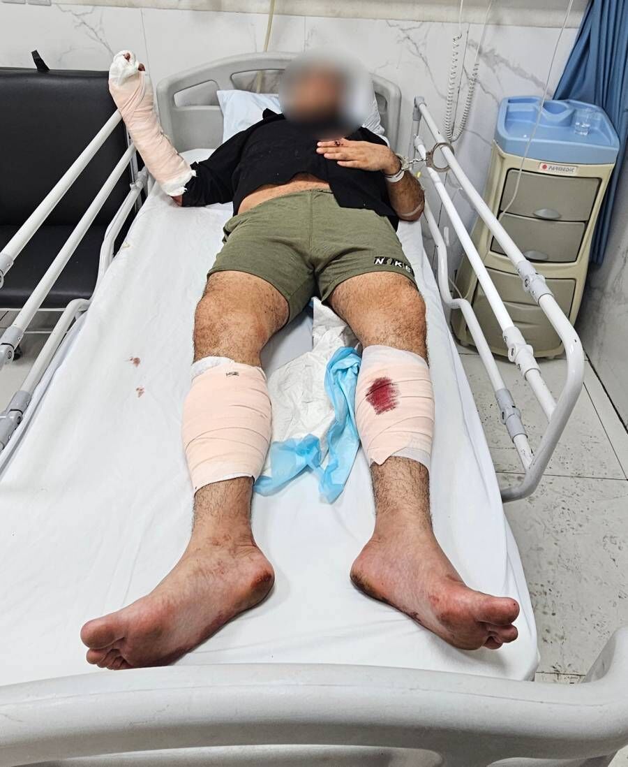 عامل حمله به بانوان با شلیک پلیس زمینگیر شد